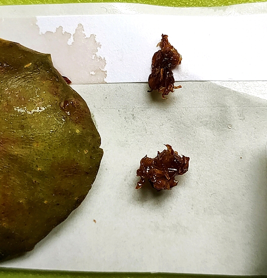 Deux masses brun�tres � identifier, extraites de l'infrutescence de la figue m�re D1.