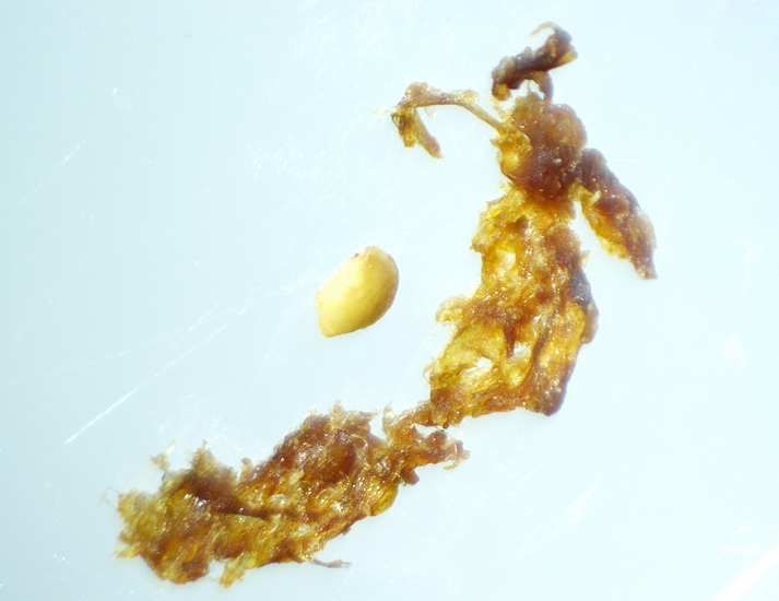 Fragmentation et �crasement sous st�r�omicroscope de la masse brun�tre.