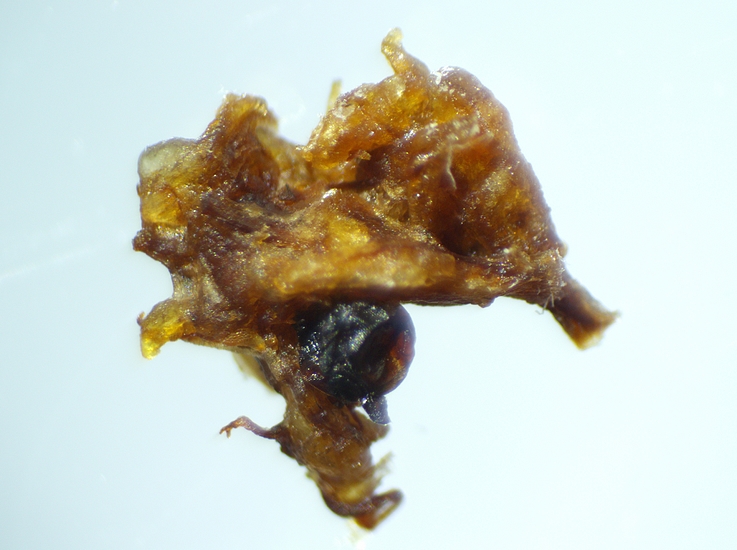 Examen sous st�r�omicroscope d'une masse brun�tre avec boule noir�tre.