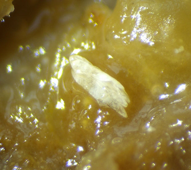 Trois chorions de Silba adipata McAlpine sous une �caille ostiolaire de la figue m�re 'Dalmatie' n�4.
