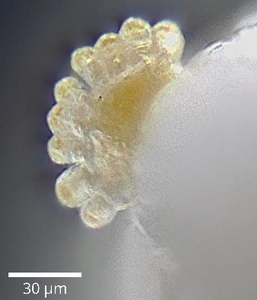 Larve de Silba adipata McAlpine : stigmate ant�rieur.